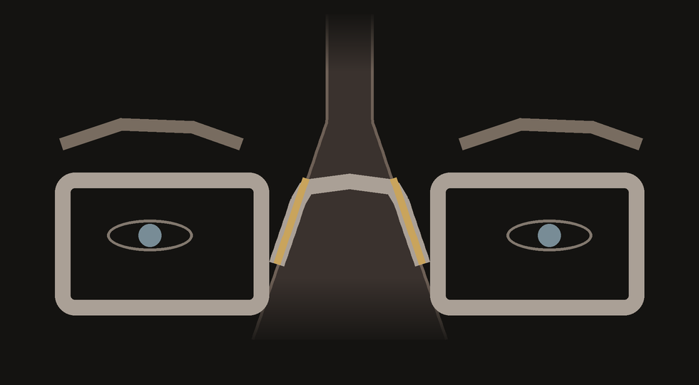 Diagram: the Woolet keyhole bridge rests along the sides of a wide nose bridge, keeping the eyes centred in the lenses and the eyebrows clear